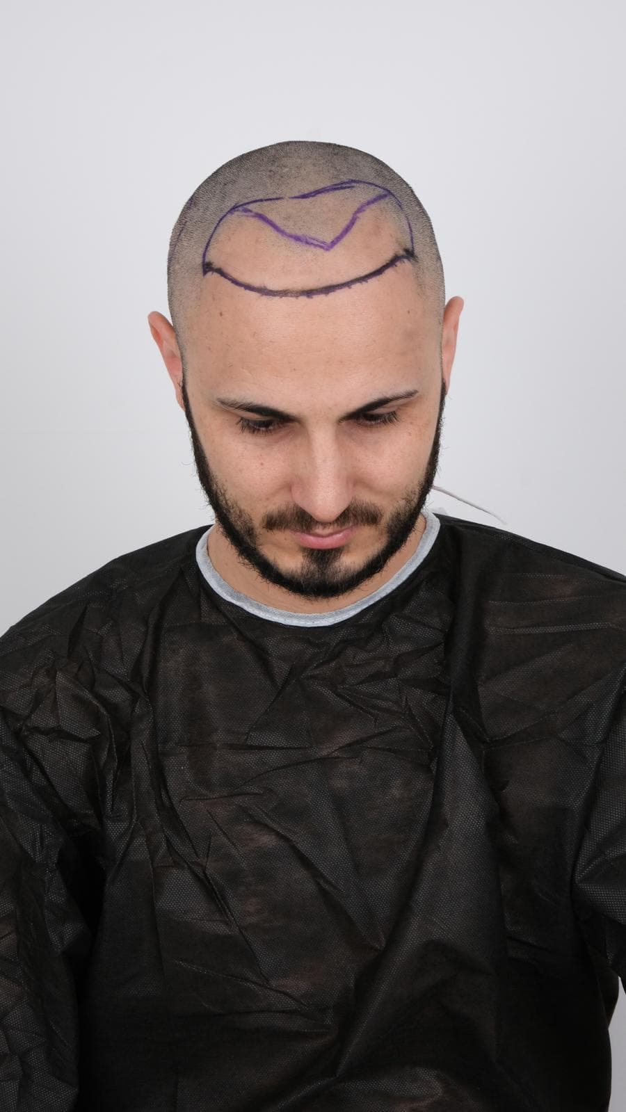 Vaka 1 / Ön Görünüm after