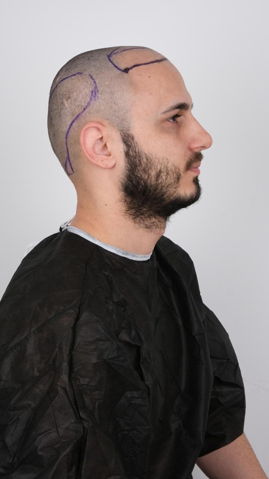 Vaka 1 / Sol Açı after