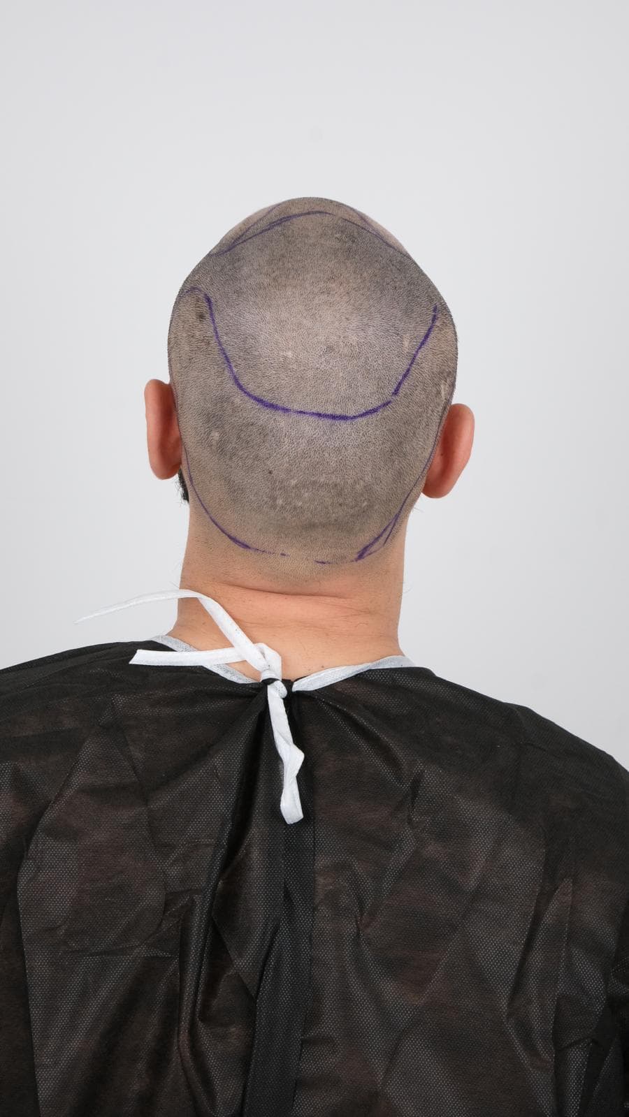 Vaka 1 / Sağ Açı after