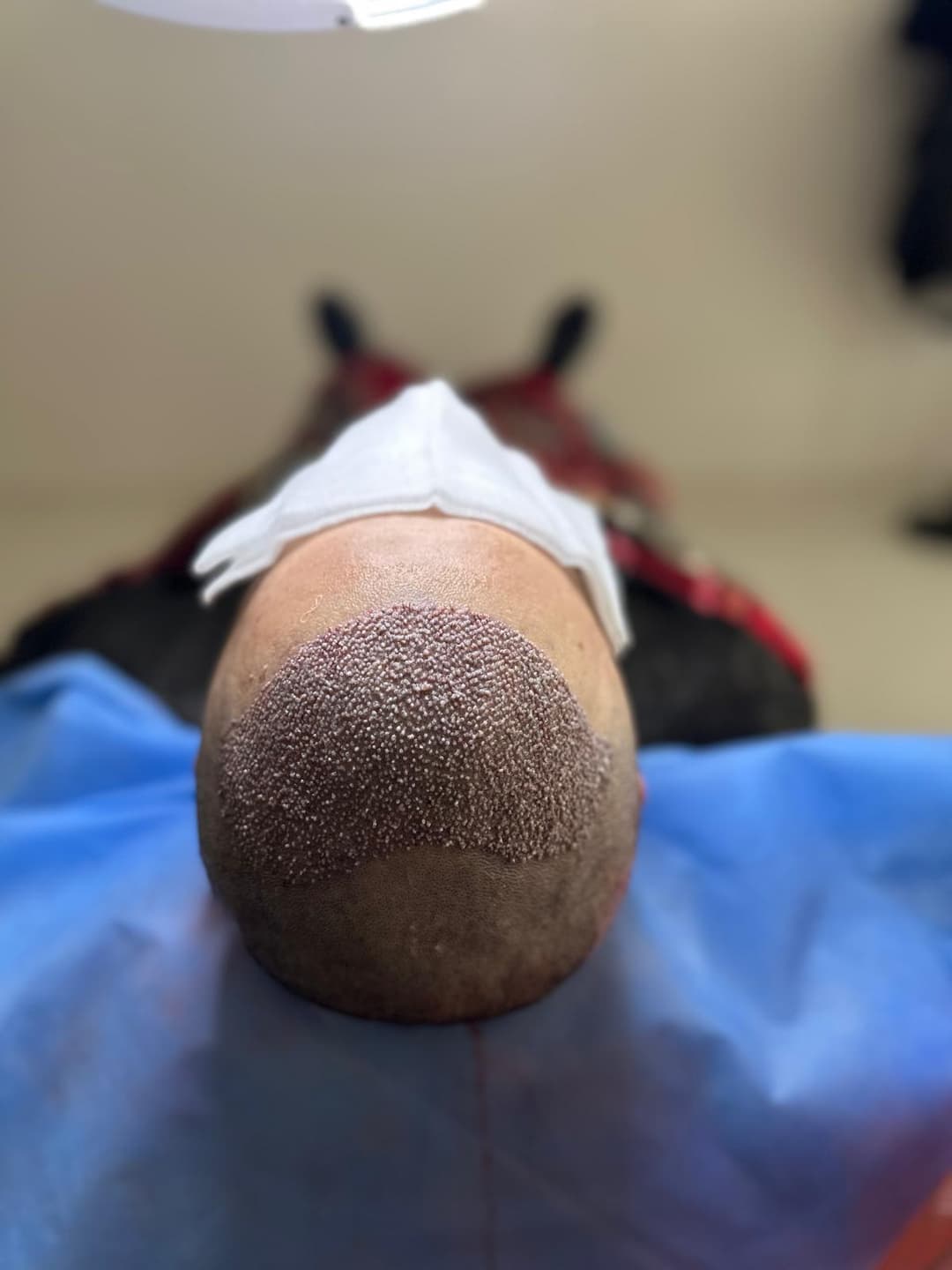 Vaka 1 / Üst Görünüm after